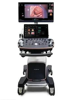 УЗИ аппарат Mindray Imagyn I9